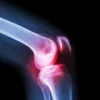 knee-sleeve webp