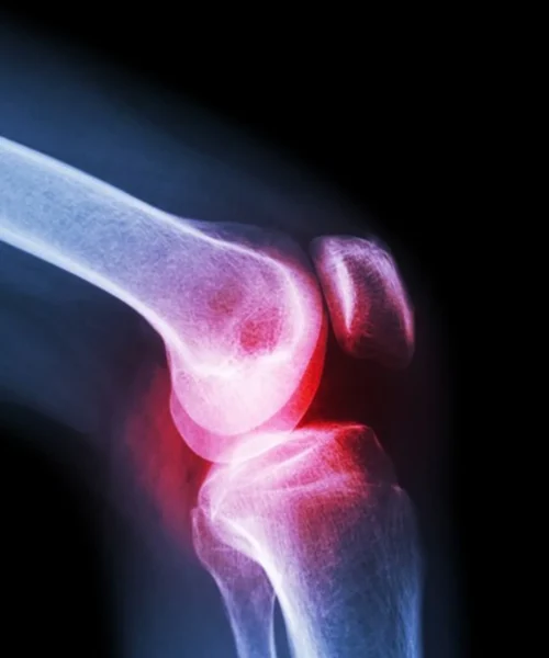 knee-sleeve webp